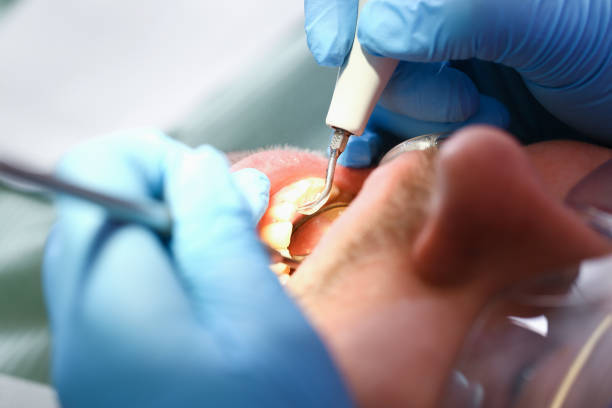 Best Emergency Treatment for Dental Infections or Abscesses in Mill City, OR