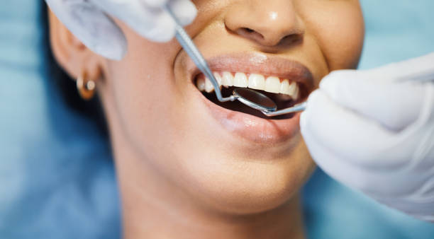 Best Urgent Care for Lost Fillings or Crowns in Mill City, OR