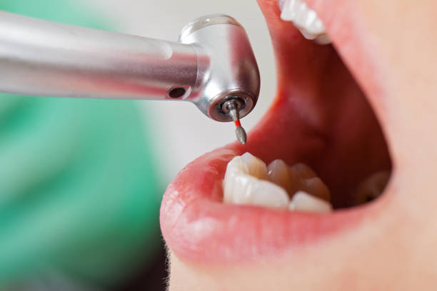 Best Pediatric Emergency Dentist in Mill City, OR